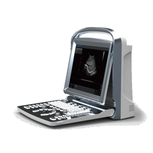 Chison ECO1 ULTRASOUND MACHINE