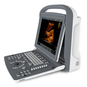 Chison ECO2 Portable Ultrasound